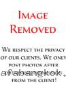 img-removed-lg